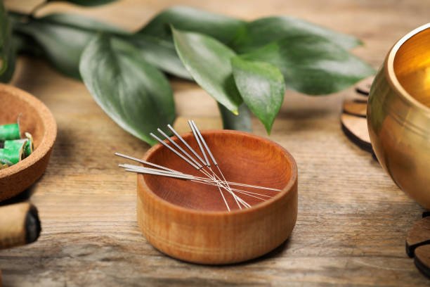Acupuncture Therapy